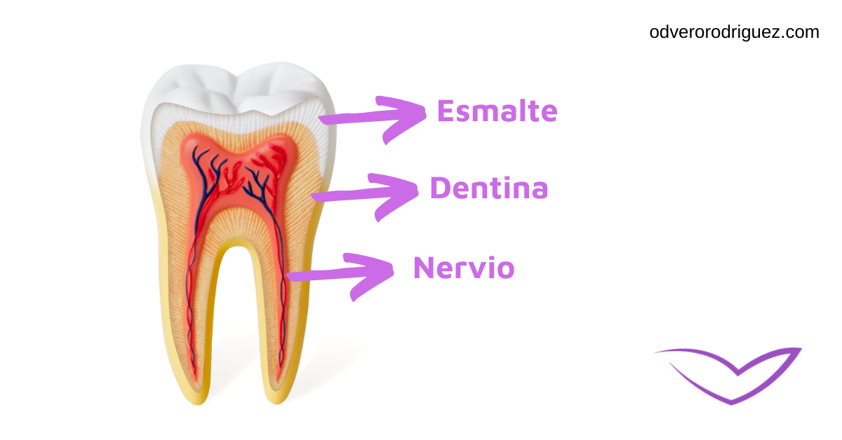 ¿Cómo quitar la sensibilidad en los dientes?