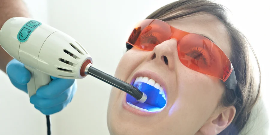 blanqueamiento dental