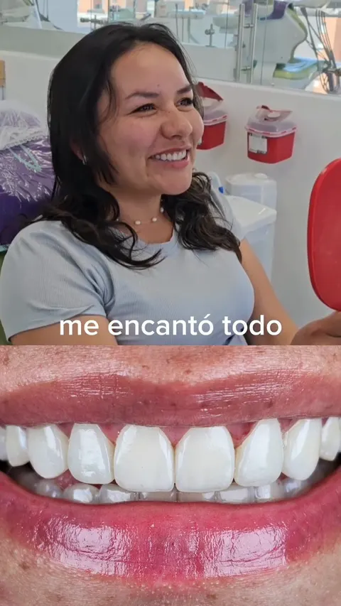 Video: Reacción a un diseño de sonrisa